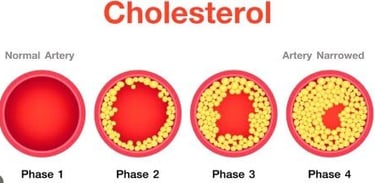 ldl and hdl cholesterol levels