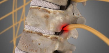 Dr.Rajinikanth's ortho clinic lumbar spondylosis