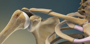 Dr.Rajinikanth's ortho clinic shoulder fracture