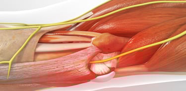 Dr.Rajinikanth's ortho clinic decompress the ulnar nerve