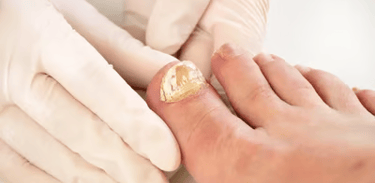 Podóloga em Aparecida de Goiânia