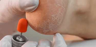 Podóloga em Aparecida de Goiânia