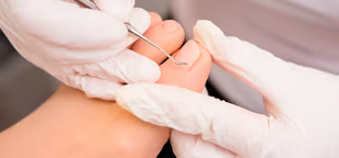 Podóloga em Aparecida de Goiânia