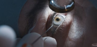 Cataract & Surgical Co-Management
