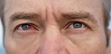 Ocular Disease Diagnosis & Management