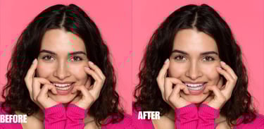 teeth-color-correction