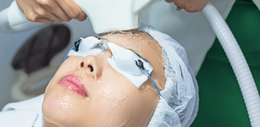 E-light rejuvenecimiento facial