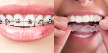 "DentalRestoration DentureCare GumSurgery OralAppliance OralHealthCare"
