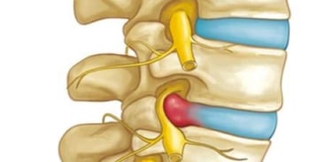 Dr.Rajinikanth's ortho clinic lumbar spine & prolapse