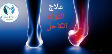 صورة علاج التواء الكاحل