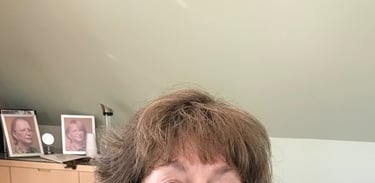 After permanent non-surgical hair replacement #6 with integration method – even coverage and natural