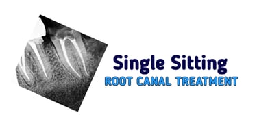 Single Sitting RCT Root Canal Treatment in Greater Noida