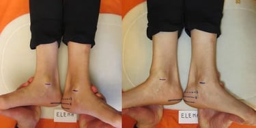 Elena Prima e Dopo Allineamento Divino