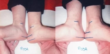 Rosa Prima e Dopo Allineamento Divino