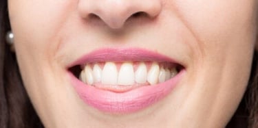 bouche femme sourire