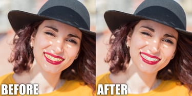 before and after teeth whitening fashion editing