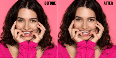 teeth-whitening-and-eye-correction