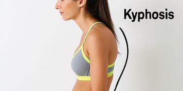 Person with stooped posture and stiff spine due to ankylosing spondylitis.