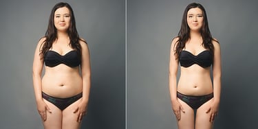 body-reshaping