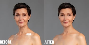 Remove Wrinkles Before and After
