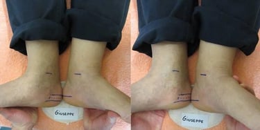 Elena Prima e Dopo Allineamento Divino