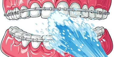 Nettoyer appareil orthodontique avec jet dentaire ozone Aquolab hygiene-precision.com