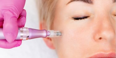 medicina estetica nina gaidau microneedling rovereto trento bolzano verona
