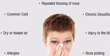 blowing of the nose