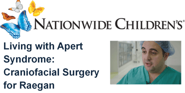 Nationwide Children&amp;amp;amp;amp;amp;amp;#x27;s Hospital video for Apert Syndrome craniofacial surgery featuring Dr. Khansa