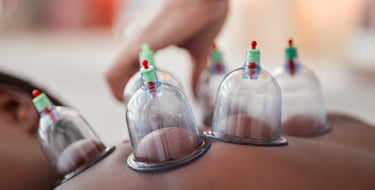 Cupping therapy offered at Soul Synergy Bodyworks, Helena, MT