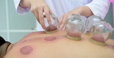 cupping therapy ou ventouses