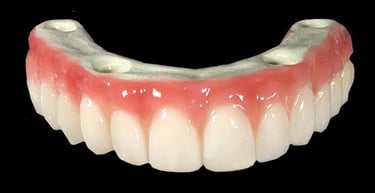 prettau-zirconia-fixed-bridge