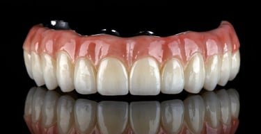 Zirconia Pretteau fixed bridge for the All on 4 procedure