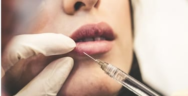 woman injecting botox into lips
