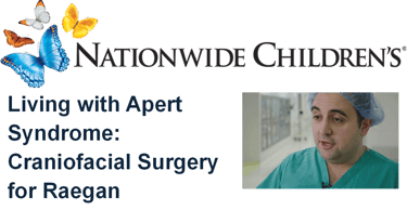 Nationwide Children&amp;amp;amp;amp;amp;amp;#x27;s Hospital video for Apert Syndrome craniofacial surgery featuring Dr. Khansa