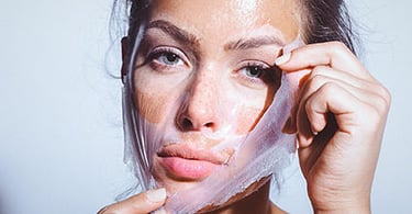 peelinguri chimice Timisoara