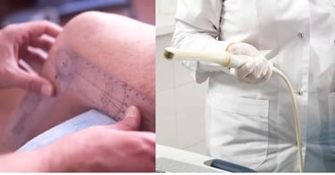 टेढ़ेपन का निदान और परीक्षण