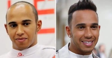 Lewis Hamilton's Hair Transformation
