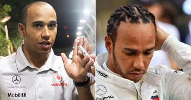Lewis Hamilton' F1 hair transplant