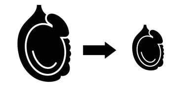 अंडकोष के छोटे होने के कारण