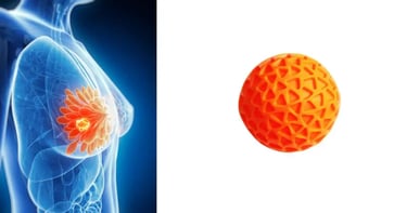 क्या स्तन में गांठ होना सामान्य है?