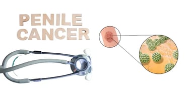 penile cancer