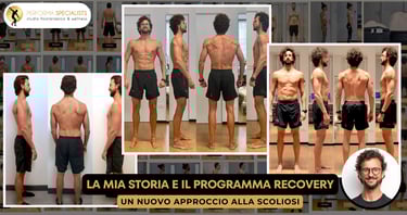 trattamento della scoliosi