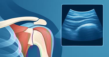 Ecografia muscolo scheletrica Qualiano. Tendiniti Borsiti Dott. Picascia