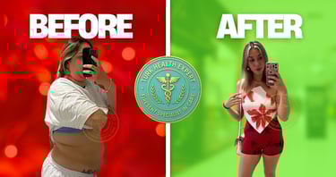 photo of result of gastric sleeve before after
