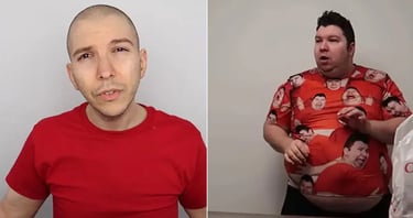 Nikocado Avocado before and after surgery