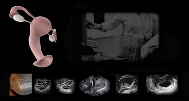 Transvaginal ultrasound training session.