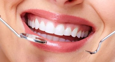 Dental crown bridge implant to restore function to bite eat and smile