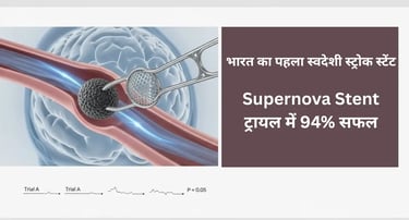 Supernova stent retriever trial success visual, AIIMS India stroke treatment innovation.