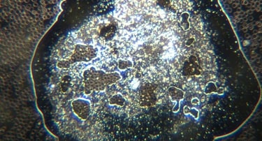 Image: large sphere with microrobots forming dense material with encased red blood cells used as an 